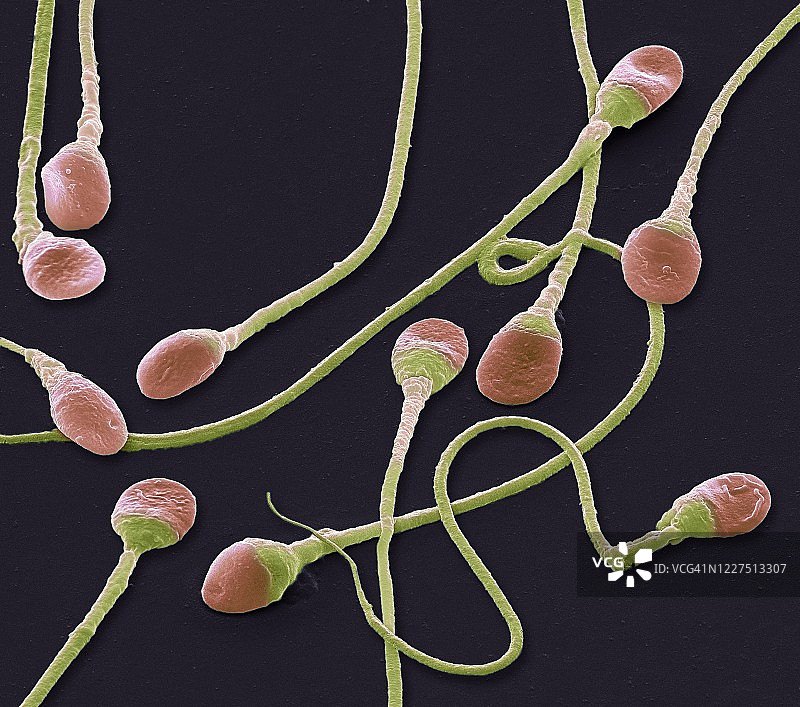 精子，扫描电子显微镜图片素材