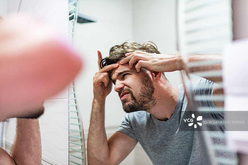 脸上长粉刺的男人图片素材
