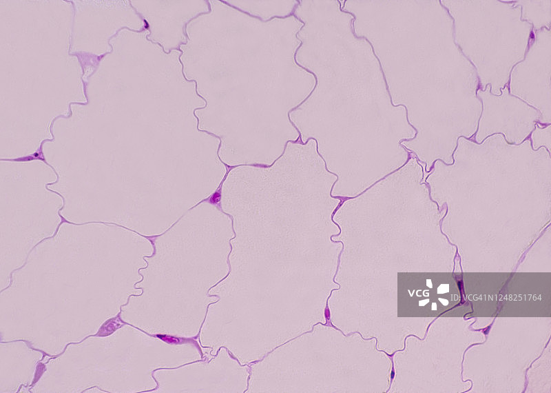 脂肪细胞显示外周核；脂肪组织，100倍图片素材