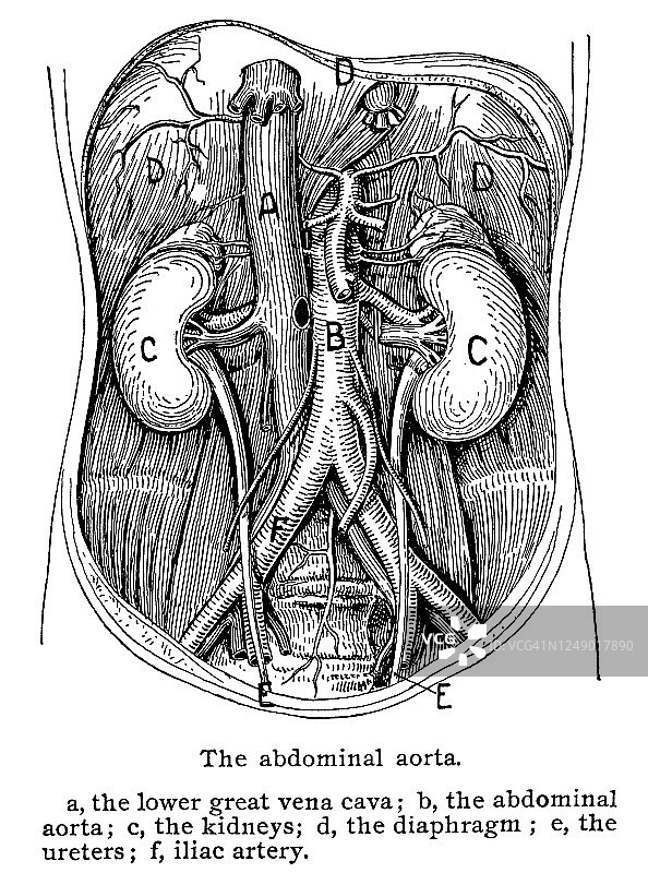 腹主动脉古老插图图片素材
