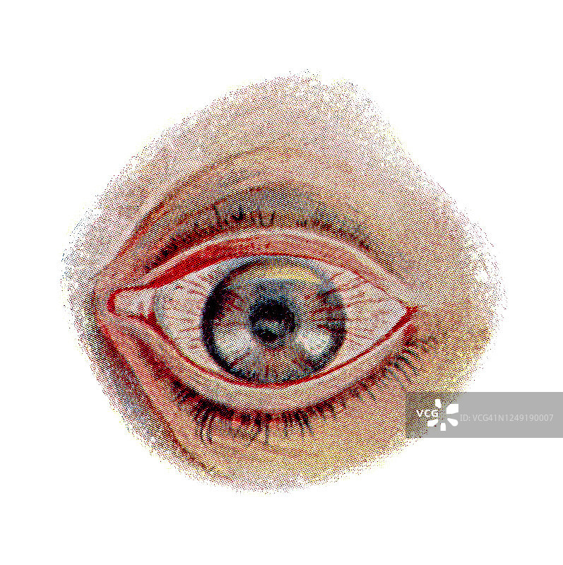 古版画：眼部感染和疾病图片素材