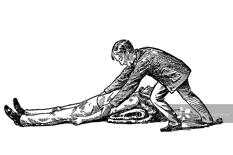 西尔维斯特医生人工呼吸法古版画图片素材