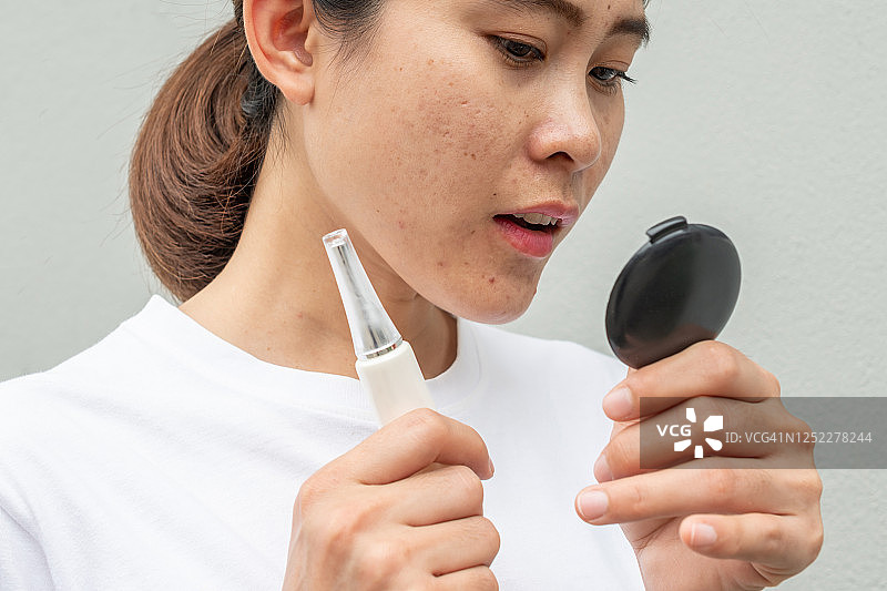 亚洲女人担心脸上出现粉刺和疤痕问题，并拿着祛痘霜进行治疗。图片素材