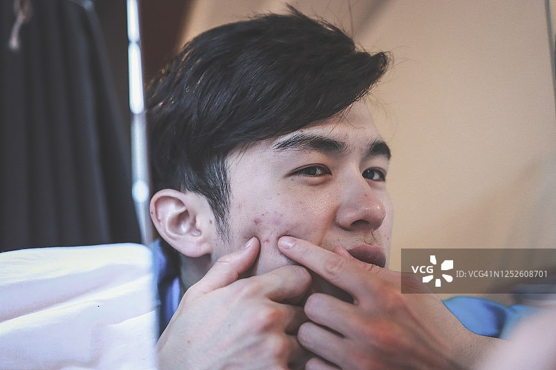 亚洲男人长了痤疮图片素材