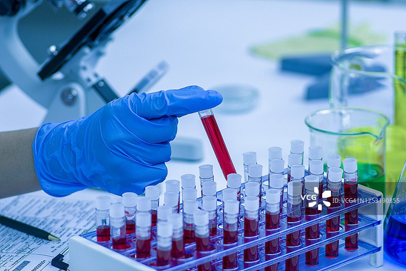 带有血样试管的实验室结果图片素材