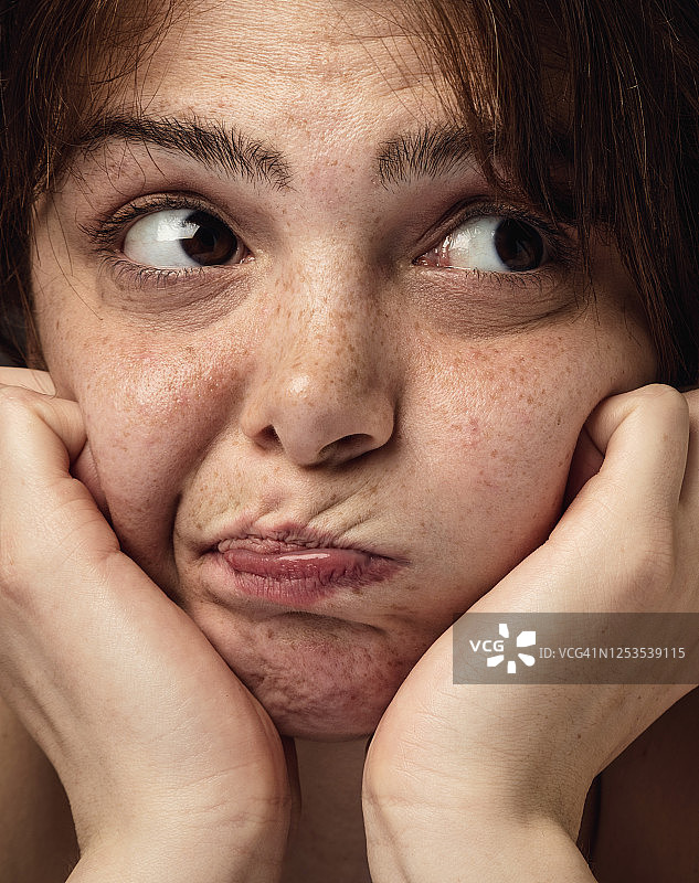 沮丧的雀斑女人面部特写图片素材
