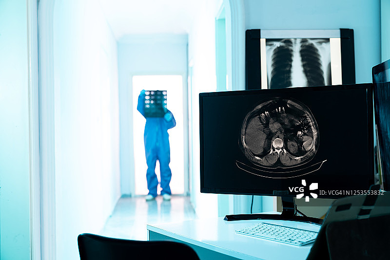放射科诊所电脑显示器上的腹部CT扫描图像图片素材