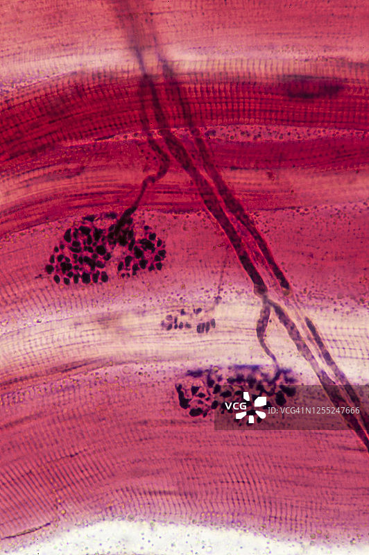 神经元支配骨骼肌细胞（纤维）和神经肌肉接头，160倍放大图片素材