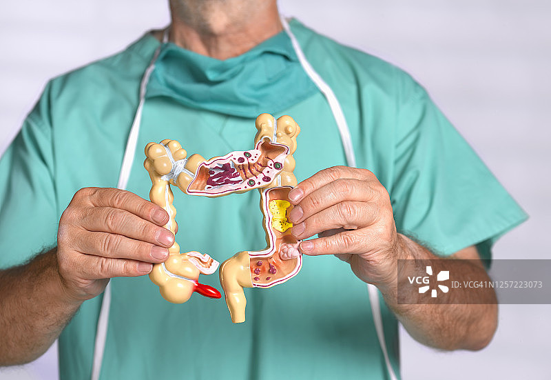 外科医生拿着常见病理的解剖模型图片素材