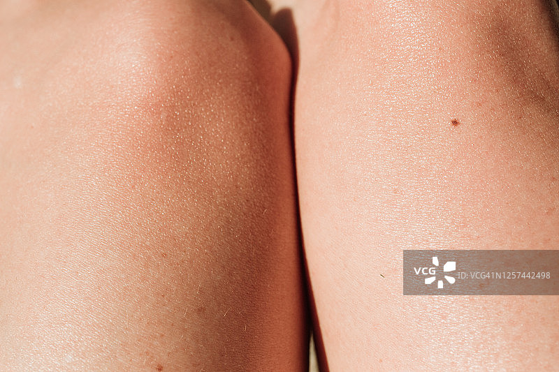 膝盖特写，腿部特写皮肤，膝关节图片素材