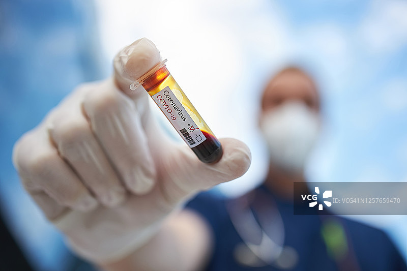 医疗医生拿着血液阳性冠状病毒测试管图片素材