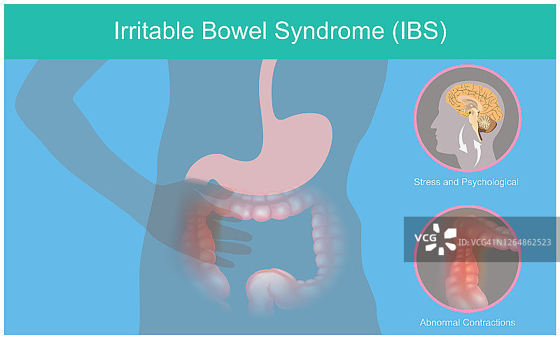 肠易激综合征：图解大脑应激反应导致的人体肠道异常收缩和疼痛感图片素材