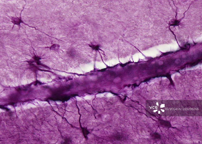 脑神经胶质细胞：星形胶质细胞与脑毛细血管的密切关系（175倍放大）图片素材