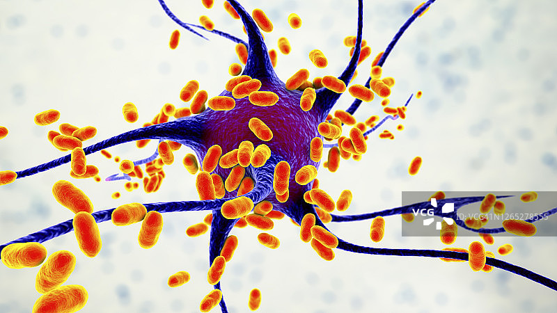 细菌性脑炎插图图片素材