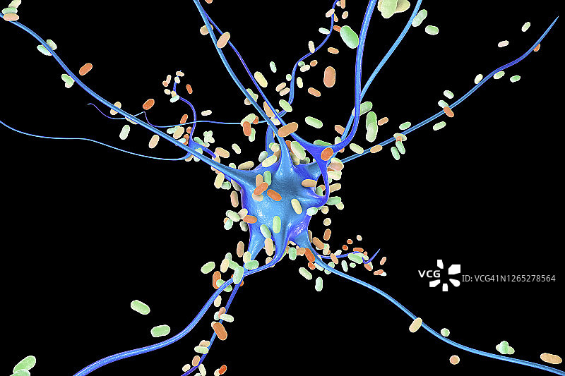 细菌性脑炎插图图片素材