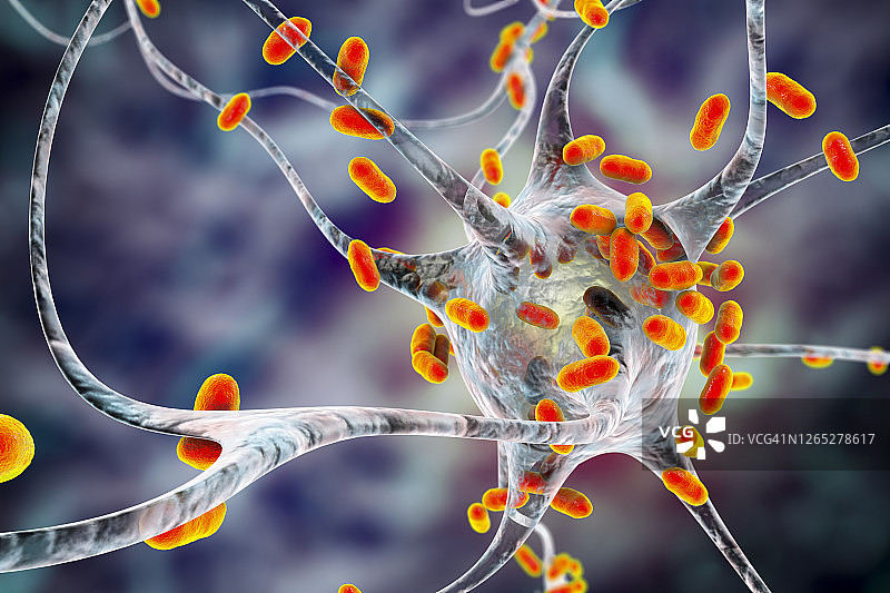 细菌性脑炎插图图片素材