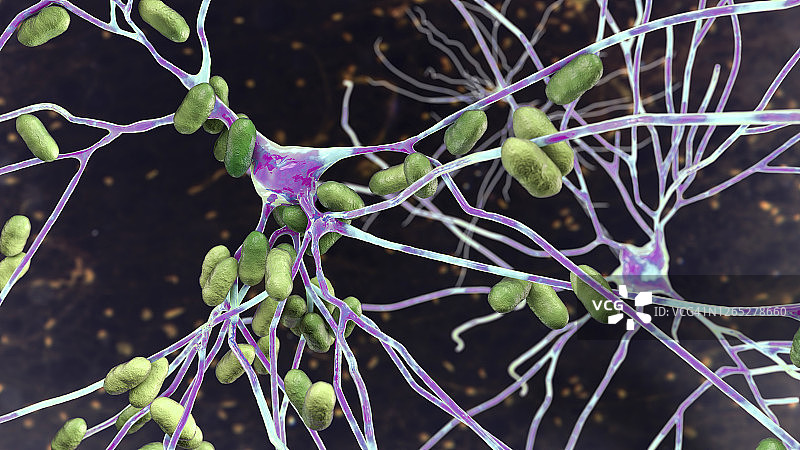 细菌性脑炎插图图片素材