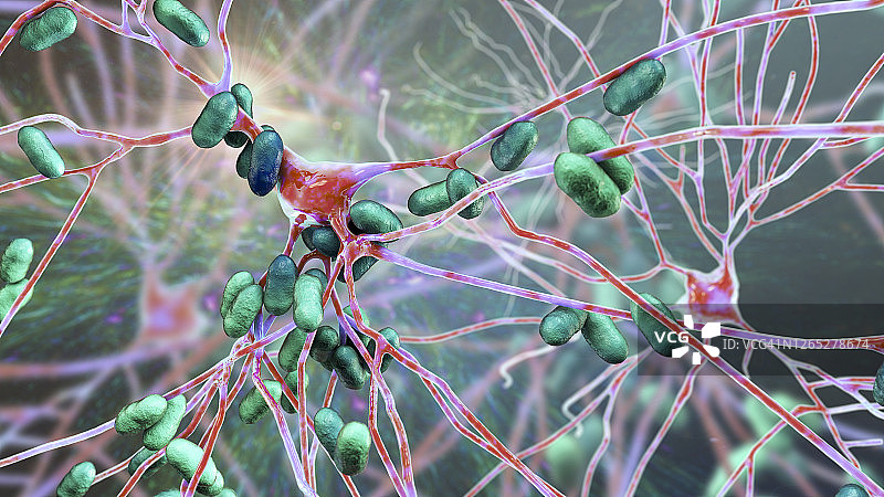 细菌性脑炎插图图片素材