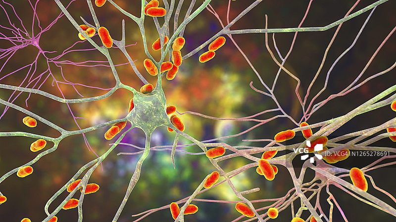 细菌性脑炎插图图片素材