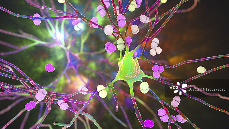 细菌性脑部感染插图图片素材