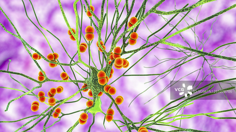 细菌性脑部感染插图图片素材