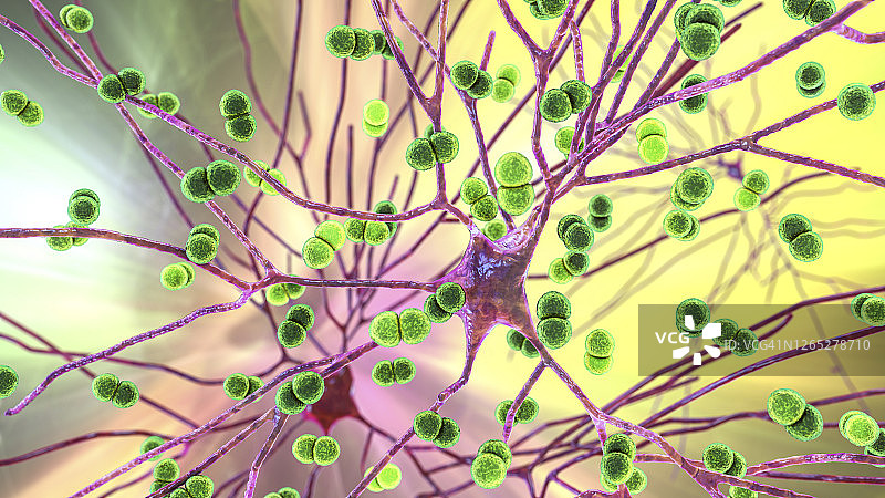 细菌性脑部感染插图图片素材