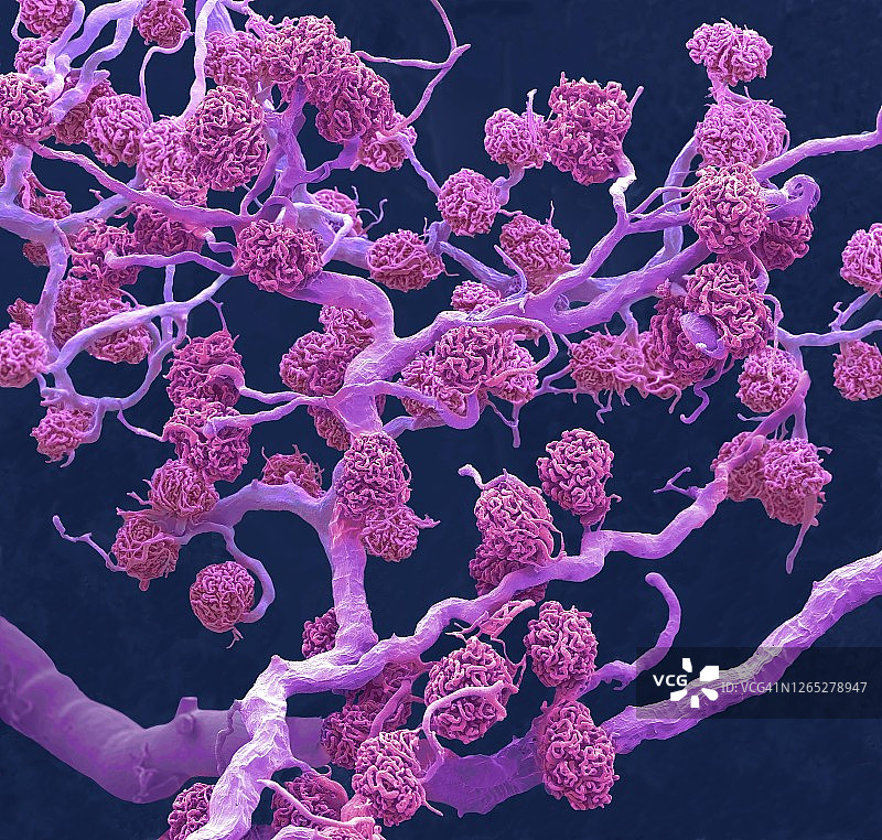 肾小球扫描电镜图图片素材