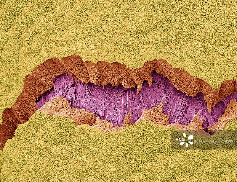 胆囊，SEM图片素材