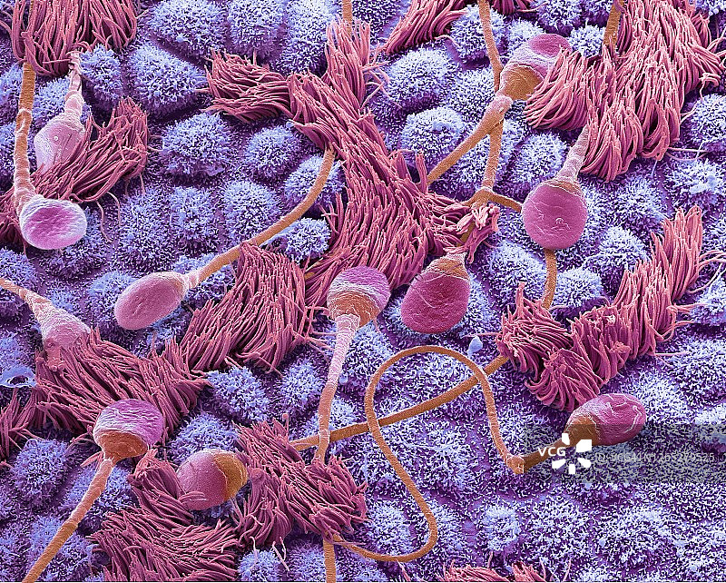 输卵管内的精子，扫描电子显微镜图图片素材