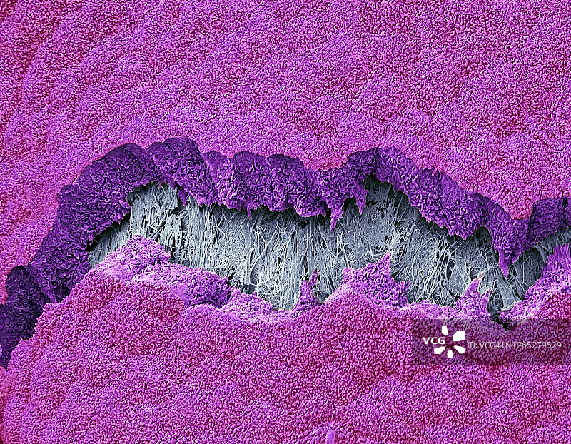 胆囊，SEM图片素材