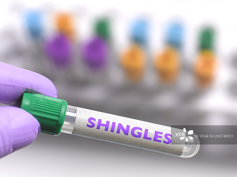 含有带状疱疹疫苗的试管图片素材