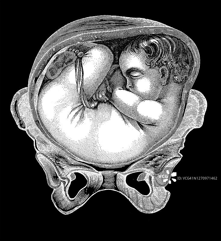 子宫内胎儿不同位置的古老雕刻插图图片素材