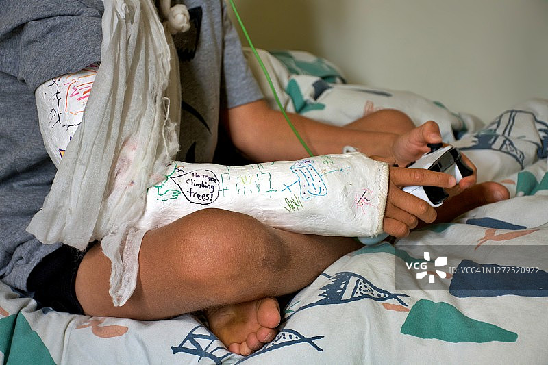 手臂骨折的孩子玩游戏图片素材