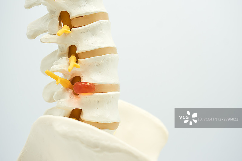 脊柱图片素材