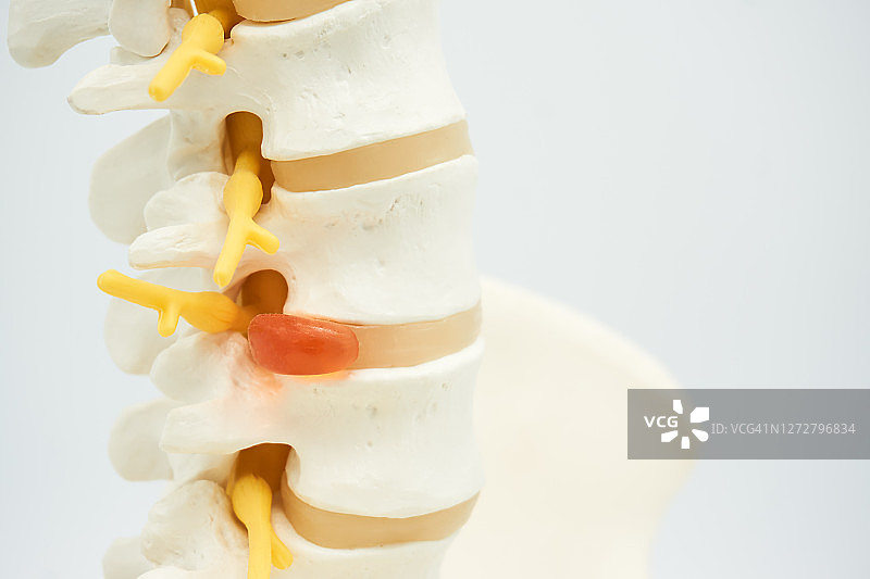 脊柱图片素材