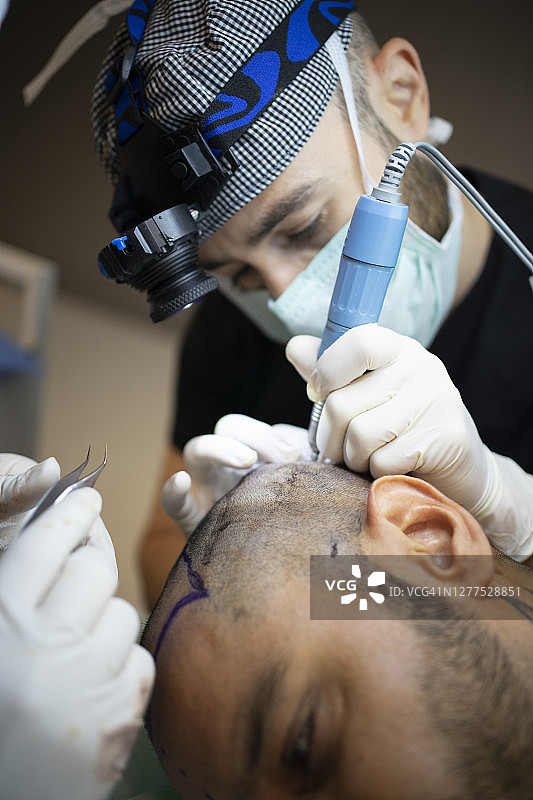 毛发移植图片素材