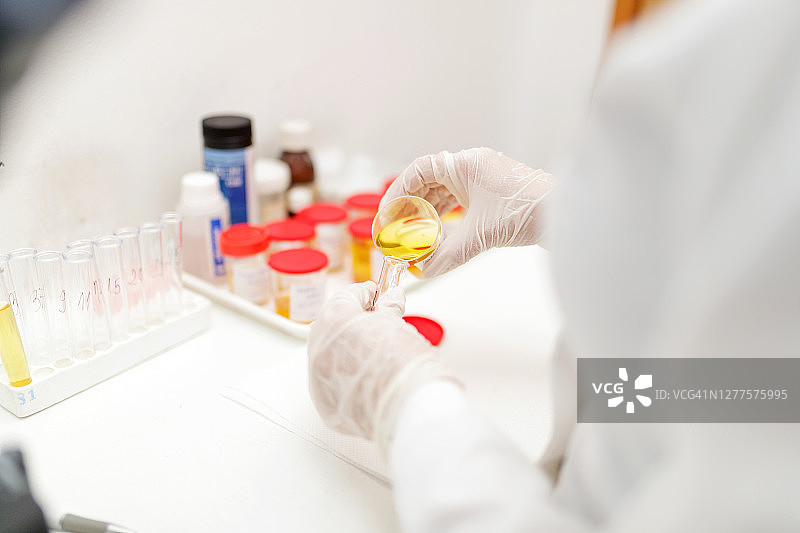 戴着防护手套的手用尿液样本填充试管图片素材