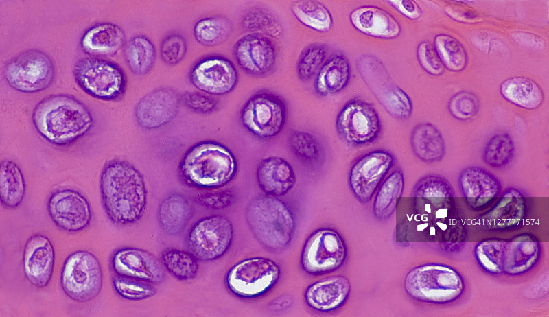 透明软骨、软骨细胞、基质与陷窝（250倍）图片素材