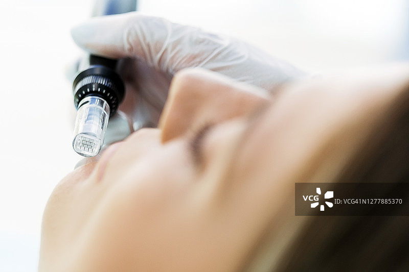 在患者皮肤上进行微针笔皮肤护理图片素材