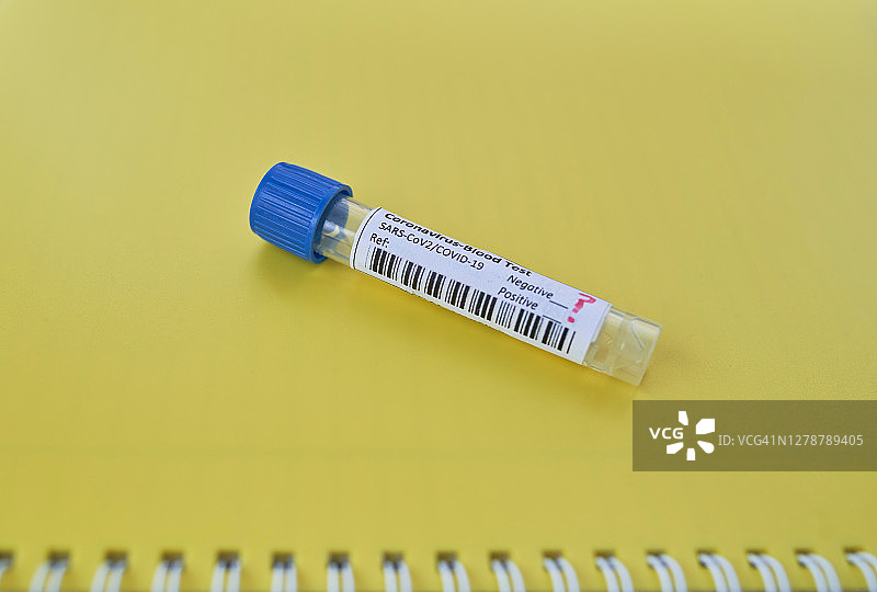 COVID-19 病毒检测管，咽拭子冠状病毒实验室检测概念图片素材