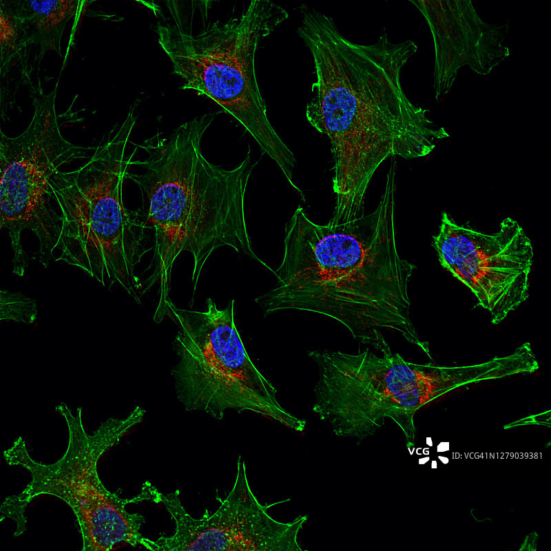 显微镜下的人类细胞：使用共聚焦显微镜评估放化疗后肌动蛋白丝（纳米技术）和形态变化图片素材