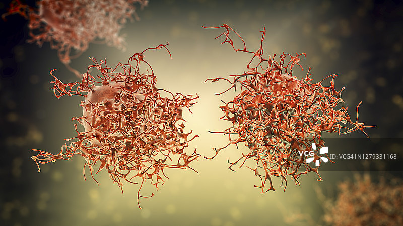 宫颈癌细胞图示图片素材