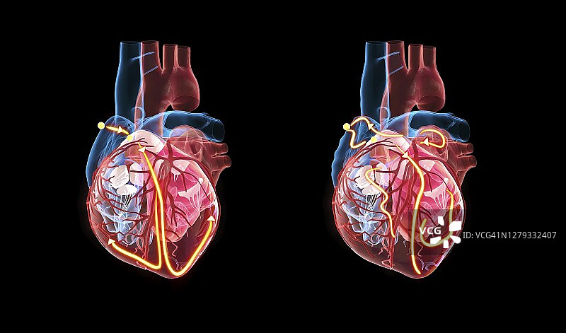 人类心脏及其电气系统，图示图片素材