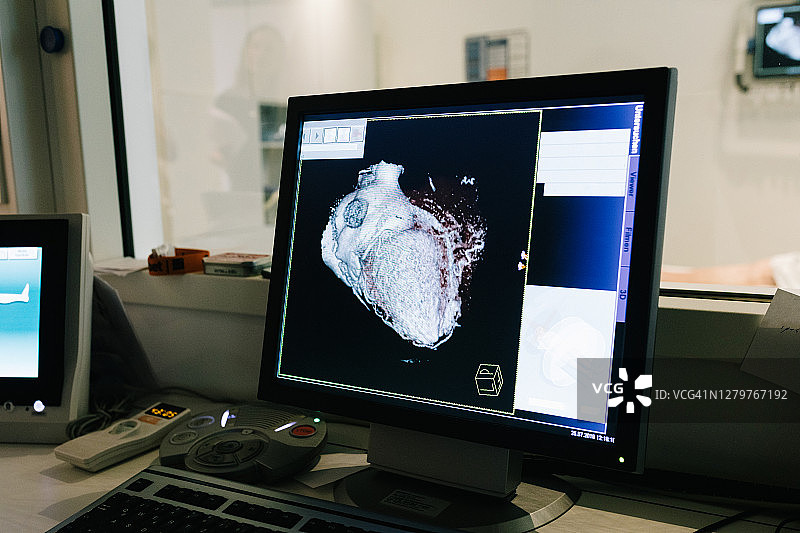 电脑屏幕上的MRI扫描特写图片素材