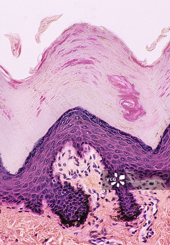 表皮组织学（微观解剖）：表皮层及鳞状细胞脱落（脱屑）200倍图片素材