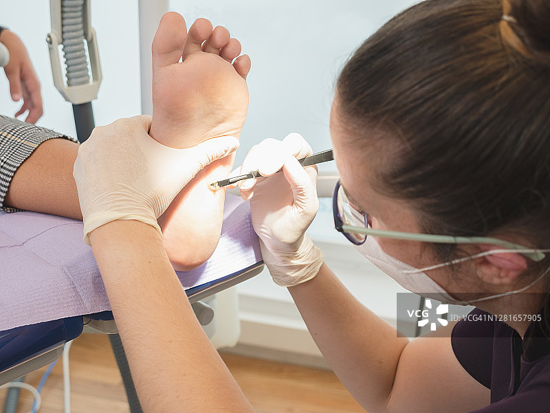 女足病医生护理患者的脚，治疗疣图片素材