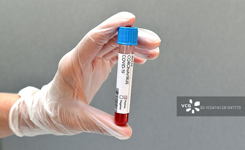 新冠病毒血液样本检测呈阳性结果图片素材
