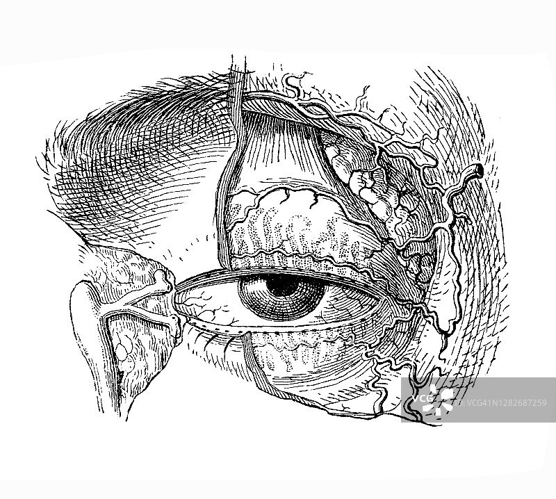 旧版画：人眼解剖，睑板腺图片素材