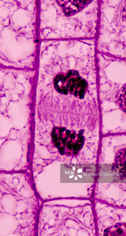 洋葱根尖有丝分裂末期图片素材