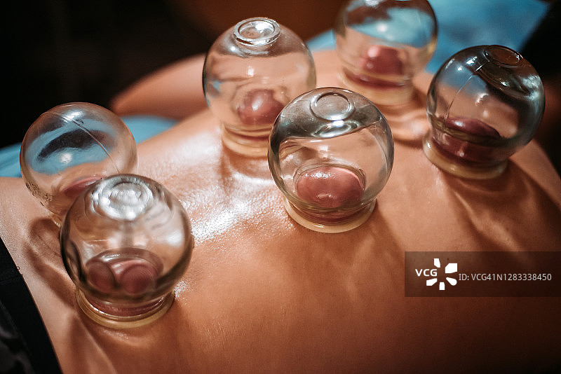 在中国药店接受拔罐治疗的中国男患者图片素材